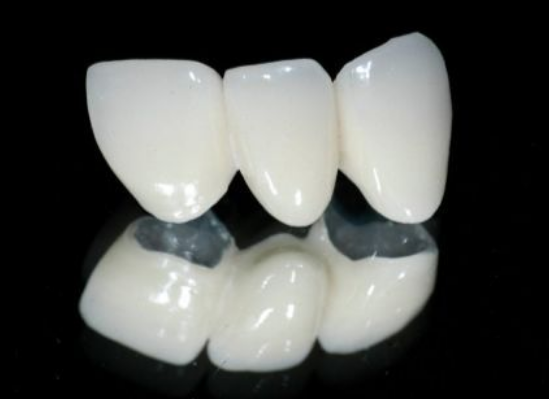 30b957f0e940af548b364b487137c590.png 烤瓷牙.png